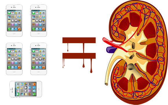 Chinese kid sells kidney to buy an iphone